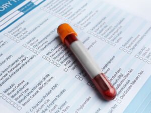 Unlocking the Secrets of Your Health: The Ultimate Guide to Blood Testing in Rochester, NY