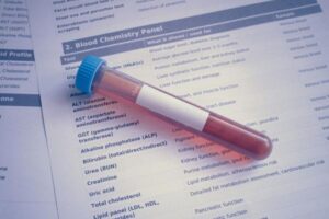 Testosterone Blood Test in the UK: Timing, Results and Next Steps